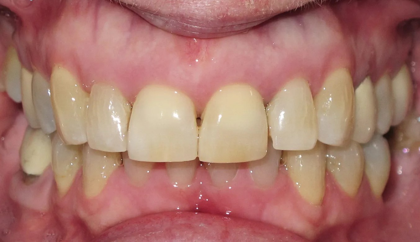 Afterteeth3. Jpg