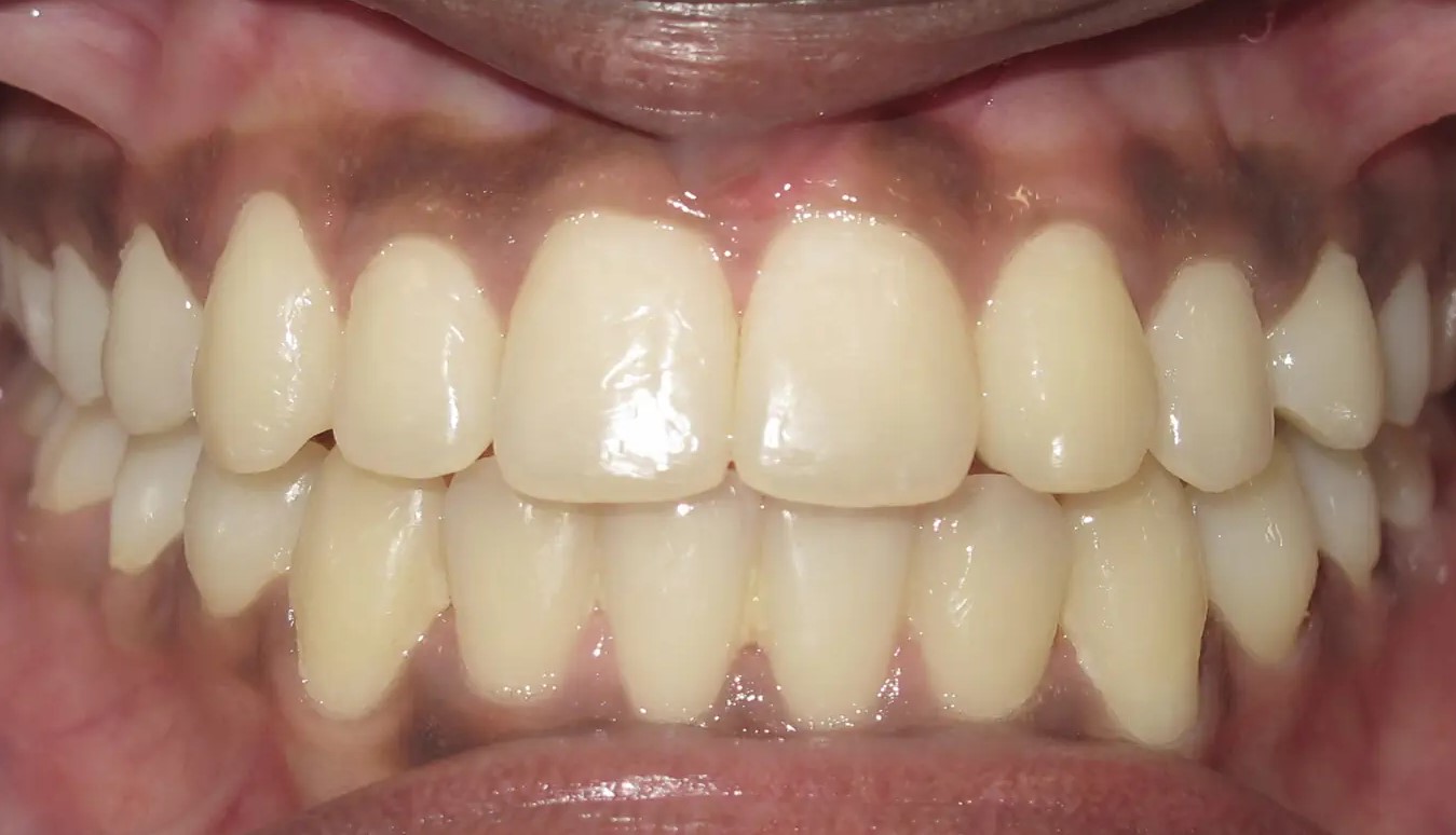 Afterteeth4. Jpg