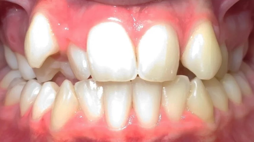 Beforeteeth1. Jpg